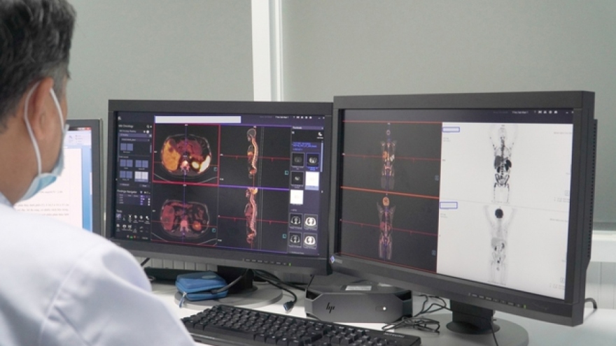 Việt Nam pha chế thành công thuốc phóng xạ mới theo dõi điều trị ung thư