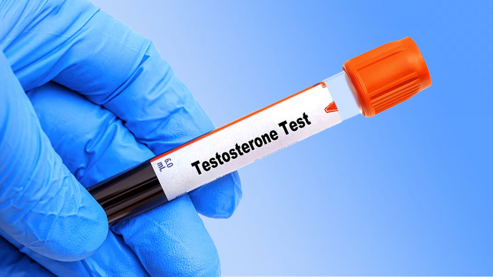 Những điều nam giới nên biết khi kiểm tra Testosterone