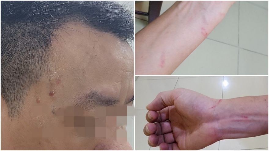 Xác minh việc 2 phóng viên bị hành hung khi tác nghiệp đám cháy ở Thanh Trì