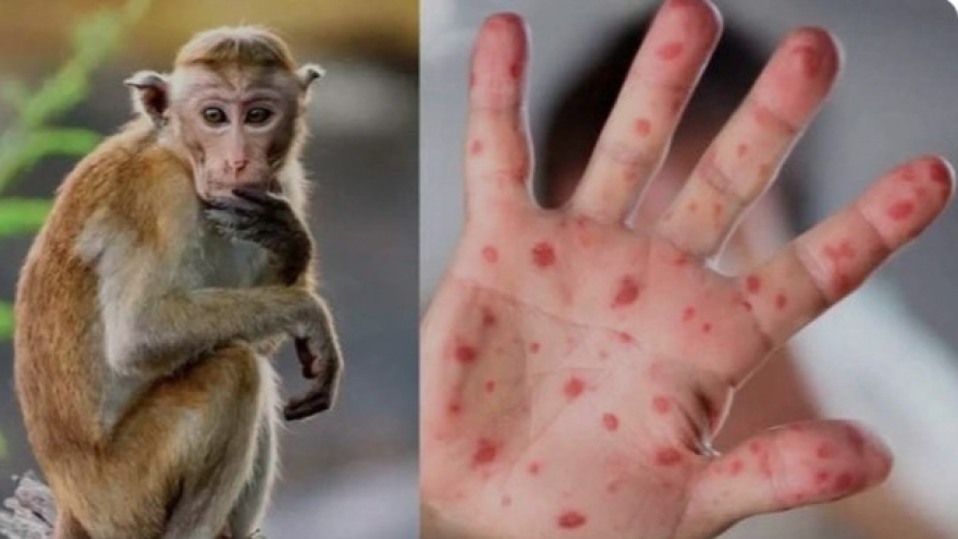 Vietnam increases health quarantine at border after WHO’s Monkeypox warnings