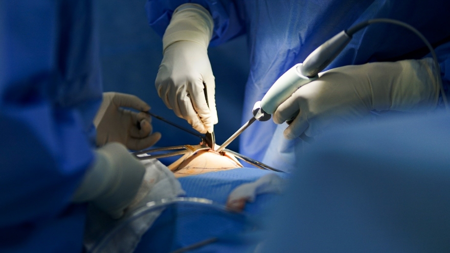 Harmo-5K - Painless breast augmentation technique exclusively