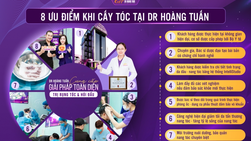 Khám phá ngay các giải pháp cấy tóc tự thân hiệu quả