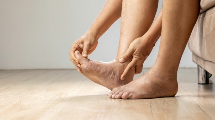 Chân xuất hiện 5 dấu hiệu bất thường này có thể thận đang "kêu cứu"