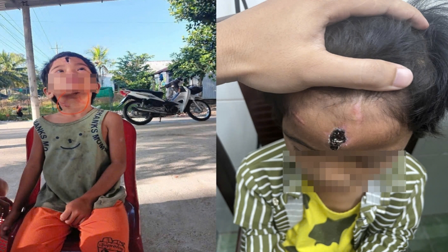 Nóng 24h: Lời khai của cha dượng bạo hành bé gái 6 tuổi