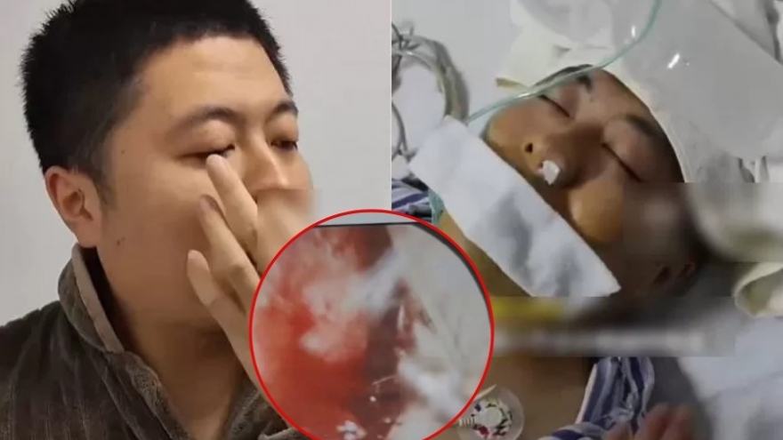 Người đàn ông vỡ động mạch, nhập viện cấp cứu vì thói quen nhiều người mắc phải
