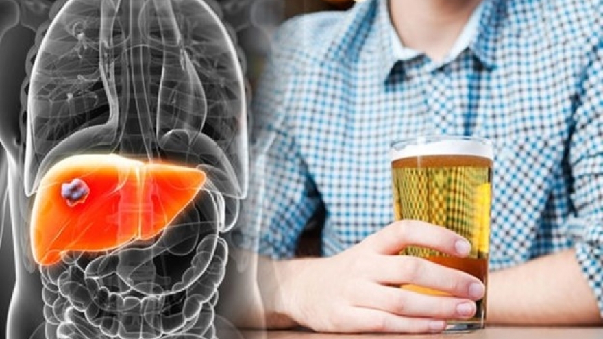 5 loại nước tàn phá gan nhanh hơn cả rượu bia, nhiều người vẫn uống hàng ngày