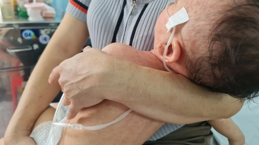 Vì sao bệnh sởi diễn tiến nhanh và nguy hiểm?