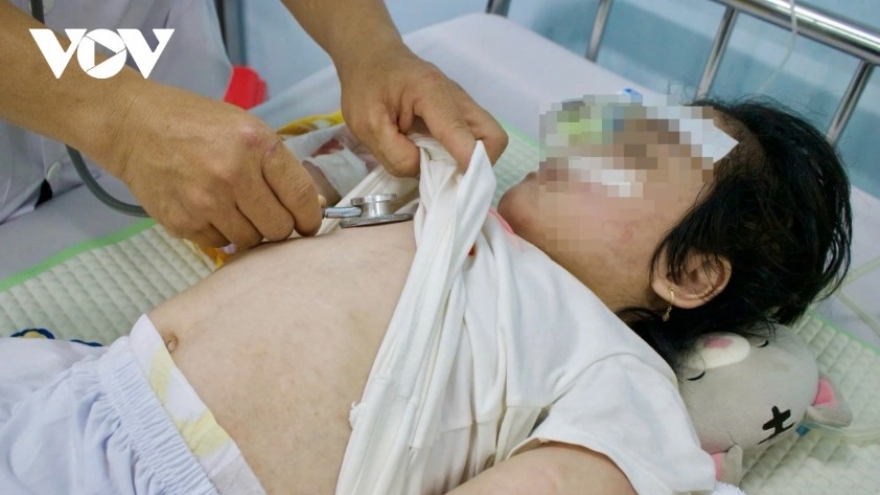 BV Nhi Trung ương đề nghị tiếp nhận các ca mắc sởi nặng