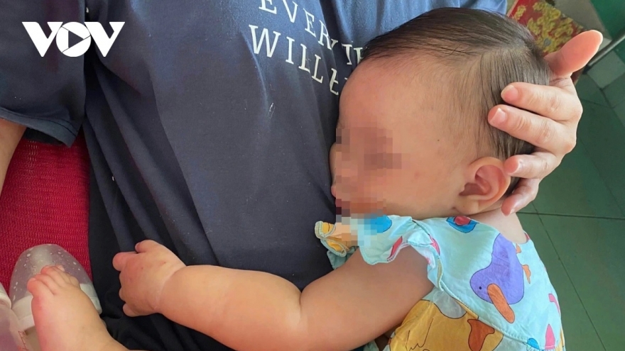 Cha mẹ không cho con tiêm phòng làm gia tăng nguy cơ tử vong khi trẻ mắc sởi