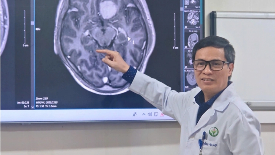 Lần đầu tiên bệnh nhân u não được phẫu thuật nội soi qua cung mày