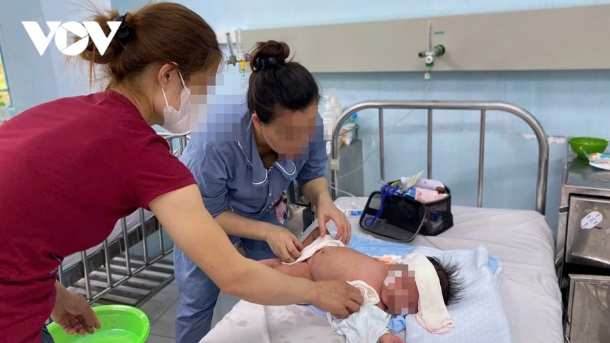 Measles outbreak remains complex, shows no signs of waning