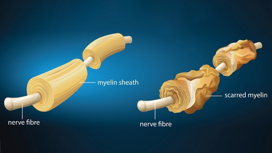 U80 lo lắng vì "cậu nhỏ" đột nhiên bị cong bất thường
