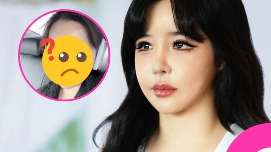 Park Bom tiếp tục gây tranh cãi với video chỉnh sửa khuôn mặt bất thường
