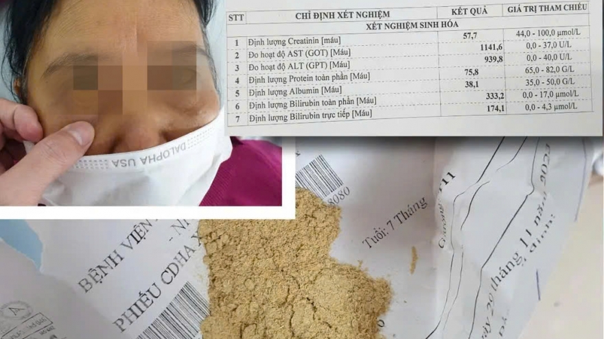 Cụ bà bị suy thận do sử dụng thuốc mua trên mạng có chứa chất cấm Phenformin