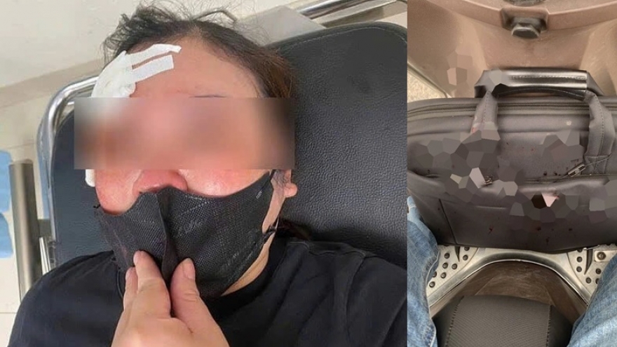 Điều tra vụ tài xế bán tải vụt dùi cui vào người phụ nữ đi xe máy tại Hà Nội