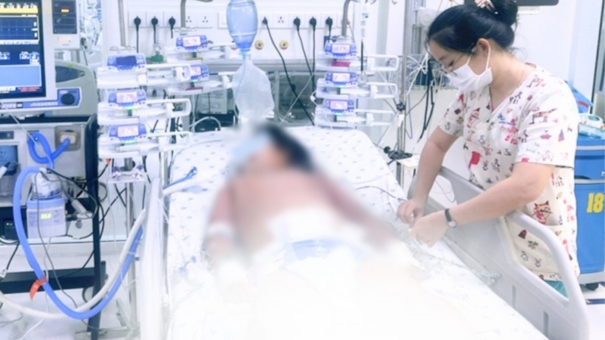 Bé gái 10 tuổi sốc sốt xuất huyết nặng, nguy kịch vì béo phì