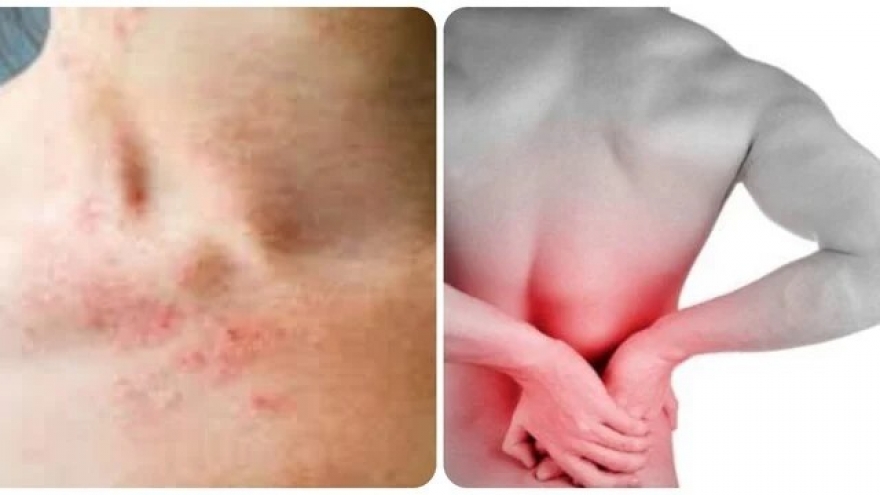 Triệu chứng suy thận nhẹ bạn cần biết