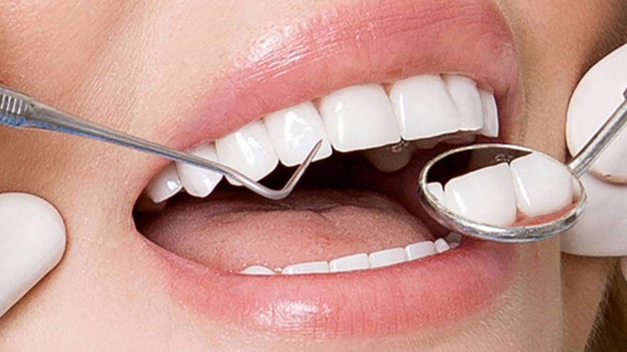 Răng sứ thẩm mỹ bảo hành trọn đời và “ma trận” giá: Người tiêu dùng lạc lối