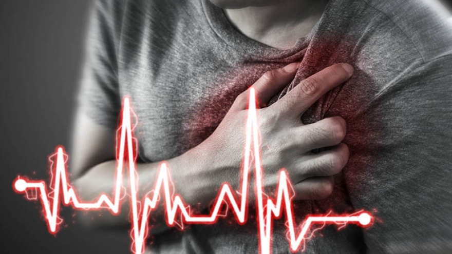 Ngừng tim đột ngột: Bác sĩ chỉ ra nguyên nhân và cách phòng tránh
