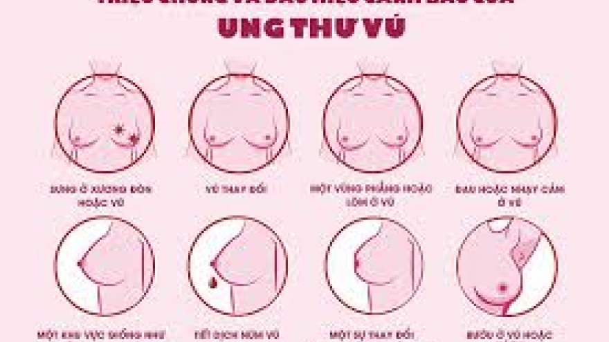 Ung thư vú không còn là “án tử” nếu được phát hiện sớm