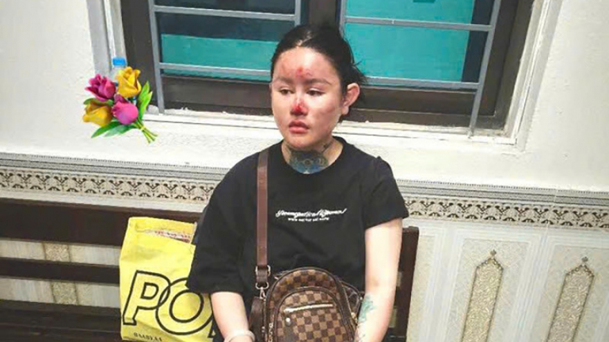 Tạm giữ hình sự Ngân "Baby"