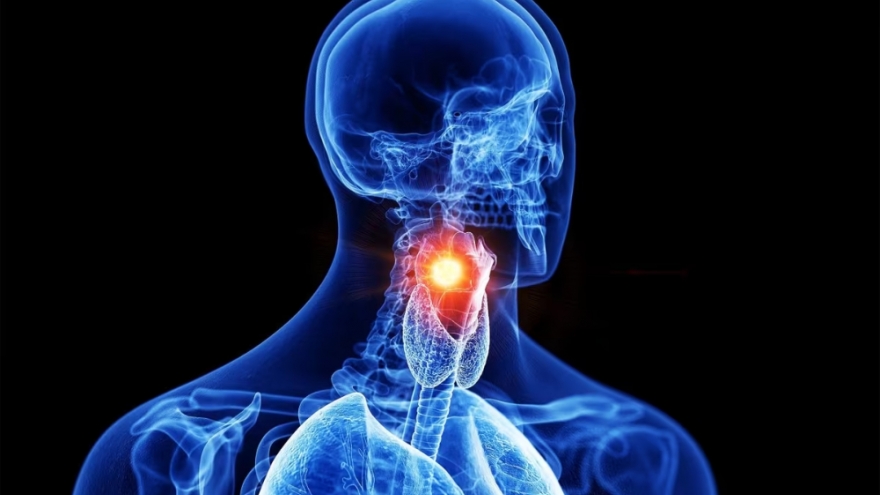 AI giúp chẩn đoán ung thư thanh quản chỉ bằng giọng nói