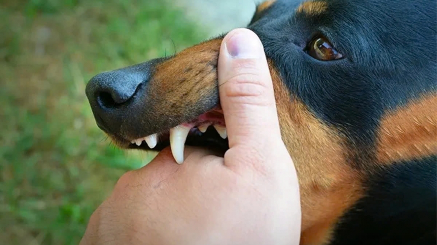 Ghi nhận 2 trường hợp tử vong do bệnh dại ở TP.HCM