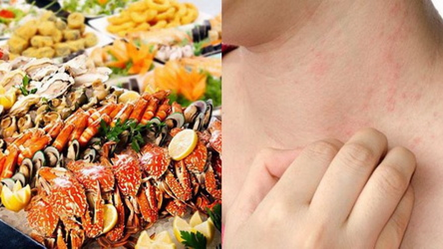 Vì sao nhiều người dị ứng cua, ghẹ: Cách phòng tránh an toàn