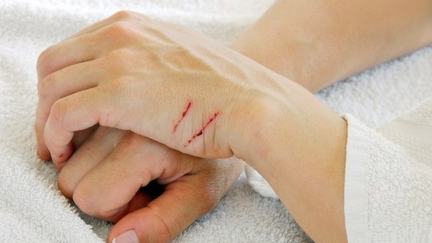 Gia đình tôi không dám nói nặng vì cô con gái bướng bỉnh thích tự làm đau mình