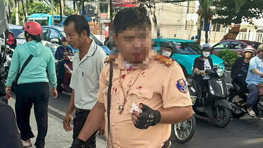 Bản tin tổng hợp: Trung tá CSGT ở Nha Trang bị người nước ngoài tấn công