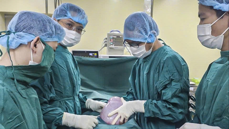 Cắt khối u buồng trứng nặng 5,5 kg cho nữ bệnh nhân 19 tuổi