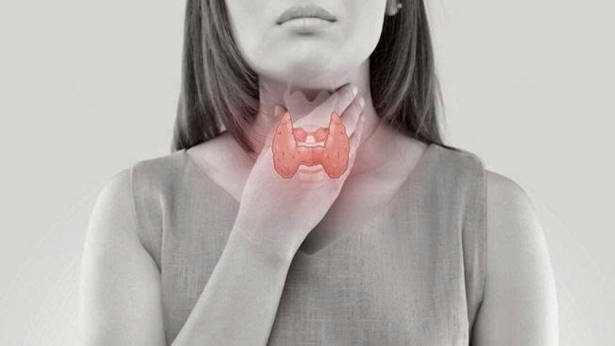 Nhân tuyến giáp: Có thực sự tan nhờ ăn uống và thảo dược?