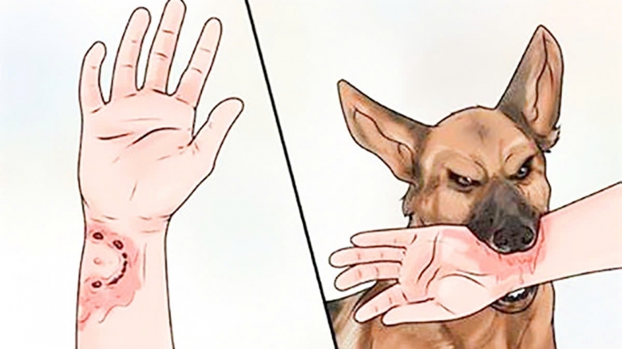 Khi cái chết đến từ vết cắn tưởng như vô hại