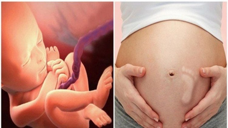 Cử động của thai nhi thế nào là bình thường và bất thường?