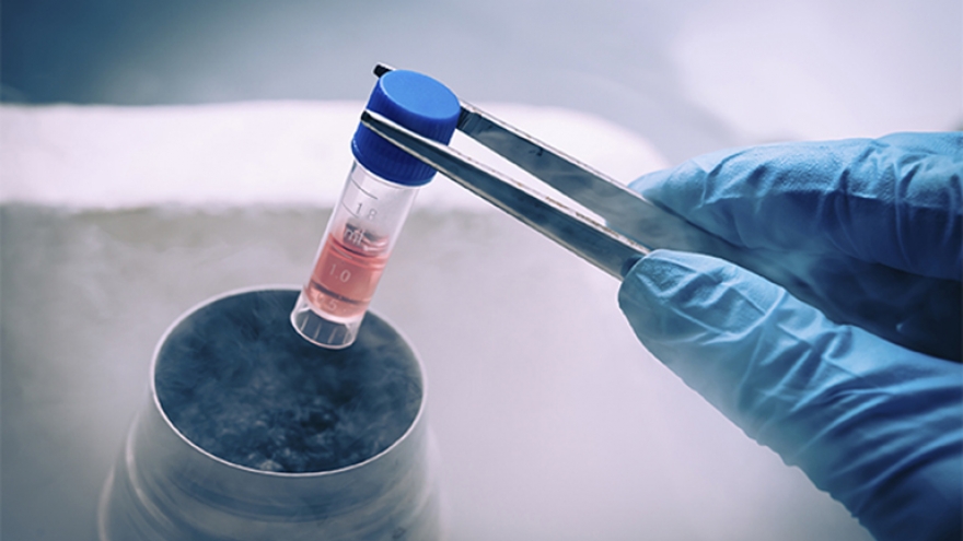 Tôi muốn trữ đông tinh trùng trước khi chính thức điều trị ung thư