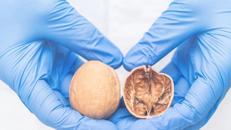 Con trai tôi 3 tháng tuổi phát hiện 1 bên tinh hoàn bị vôi hóa liệu có nguy hiểm