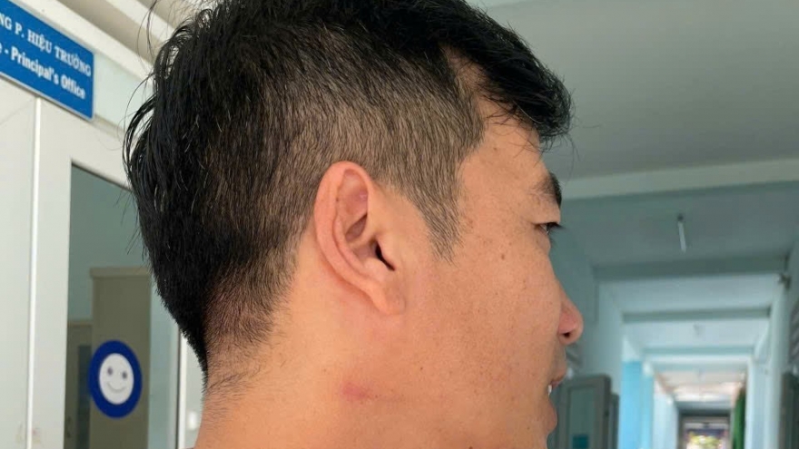 5 lần bị kỷ luật, thầy giáo vẫn bóp cổ đồng nghiệp giữa sân trường