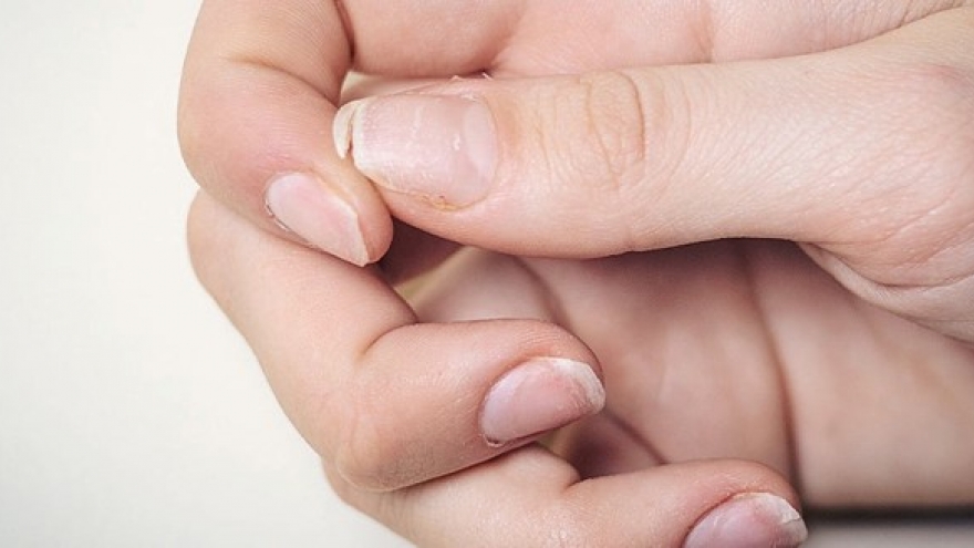 6 dấu hiệu cho thấy cơ thể đang thiếu canxi, cần bổ sung nhanh nhất có thể