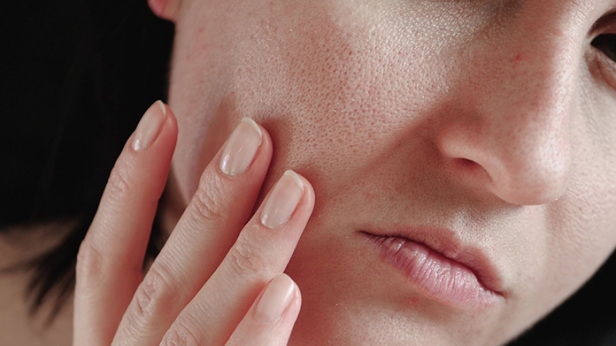 11 bí quyết giữ ẩm da hiệu quả mùa đông