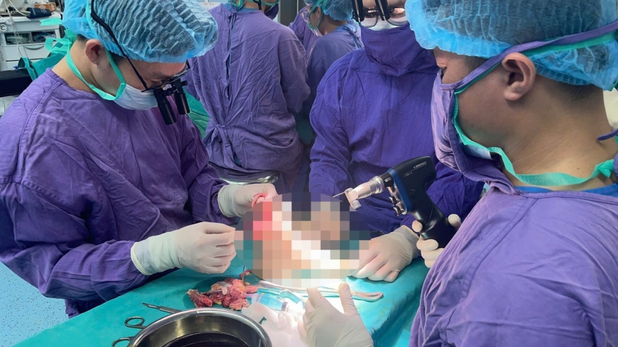 Nối thành công chân đứt lìa cho cô gái 19 tuổi bị xe tông ở Hà Nội