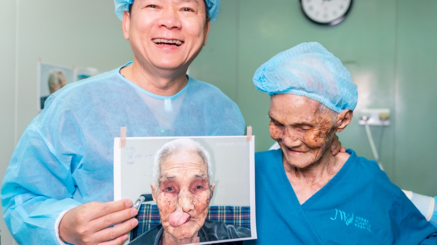 Phẫu thuật khối u mũi, cứu đường thở cho cụ bà gần 100 tuổi nặng 27kg