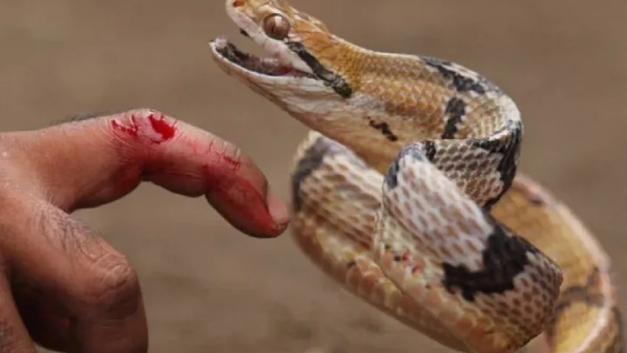 Người đàn ông 34 tuổi tử vong vì đắp lá chữa rắn hổ mang cắn