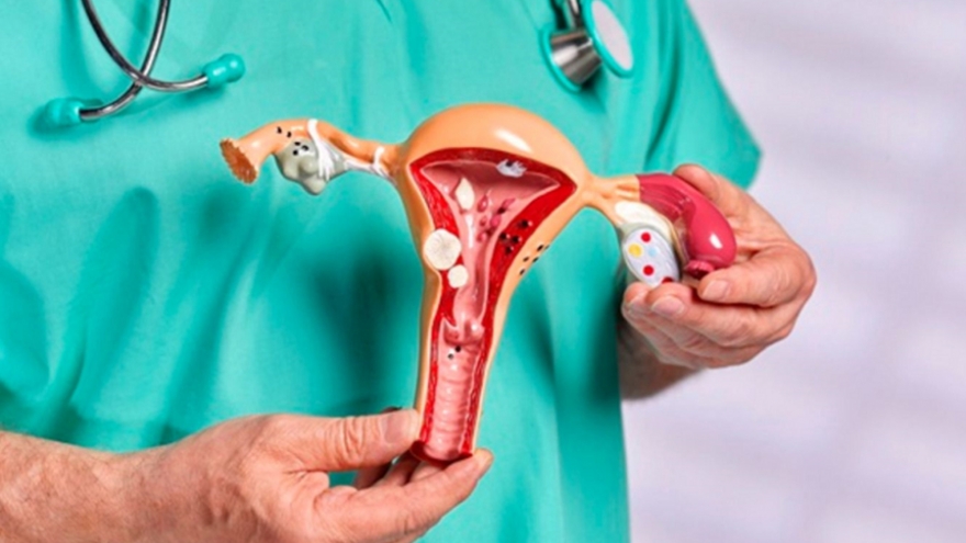 Sau phẫu thuật cắt 2 buồng trứng, việc sinh hoạt vợ chồng của tôi khá khó khăn