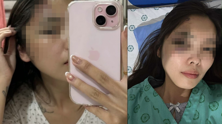 Điều tra vụ cô gái bị chồng hành hung phải nhập viện ở Hà Nội