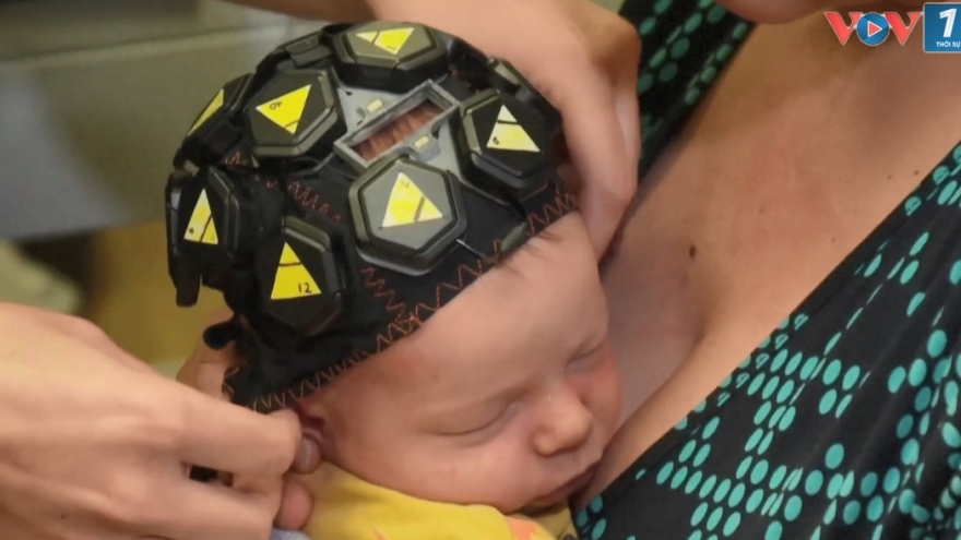 Anh thử nghiệm công nghệ giám sát hoạt động não bộ ở trẻ sơ sinh