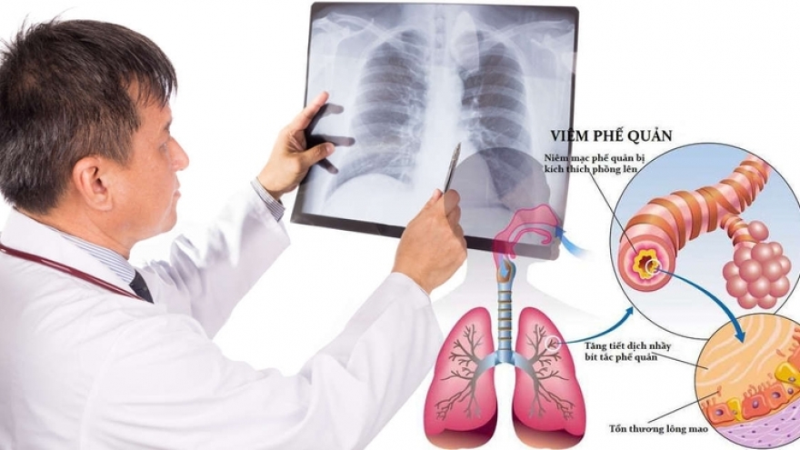 Cách giúp hệ hô hấp khỏe mạnh khi giao mùa