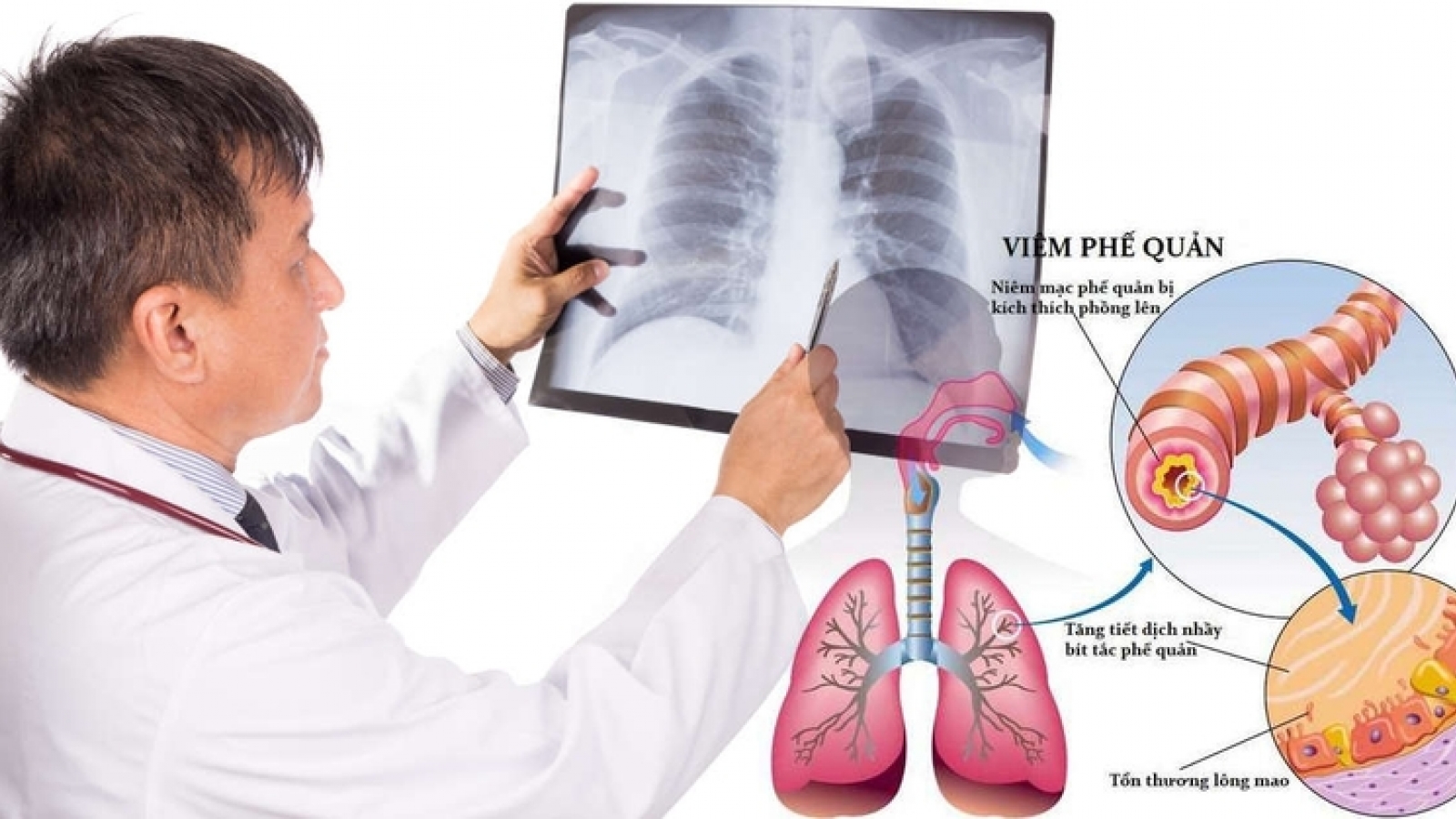 Cách giúp hệ hô hấp khỏe mạnh khi giao mùa