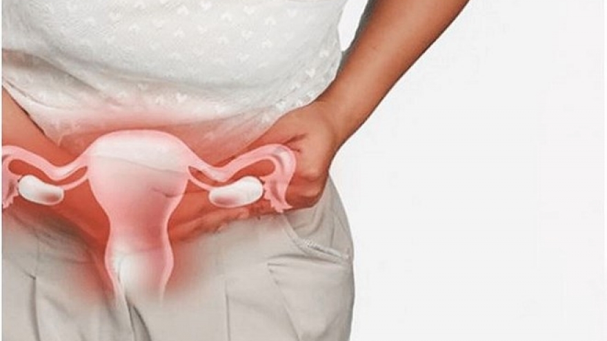 Tại sao dù vệ sinh sạch sẽ, kỹ lưỡng, tôi vẫn bị viêm nhiễm phụ khoa tái phát