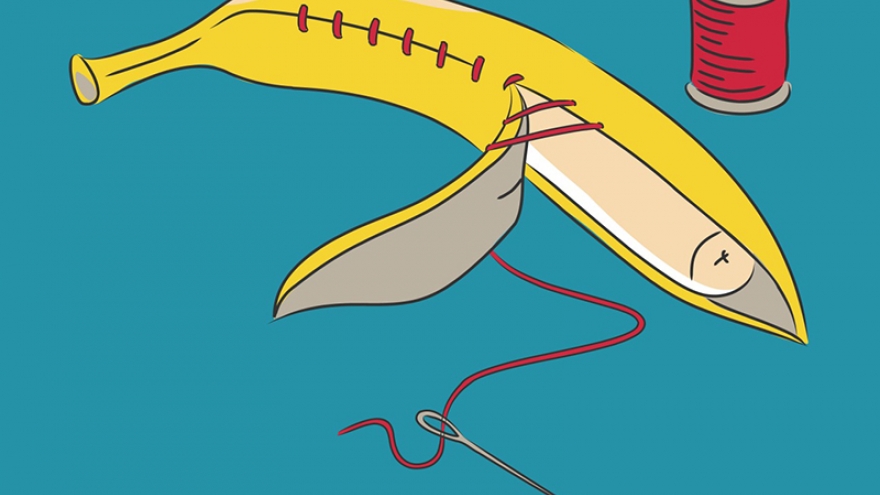 Nếu phải cắt bao quy đầu, thời điểm nào tốt nhất?