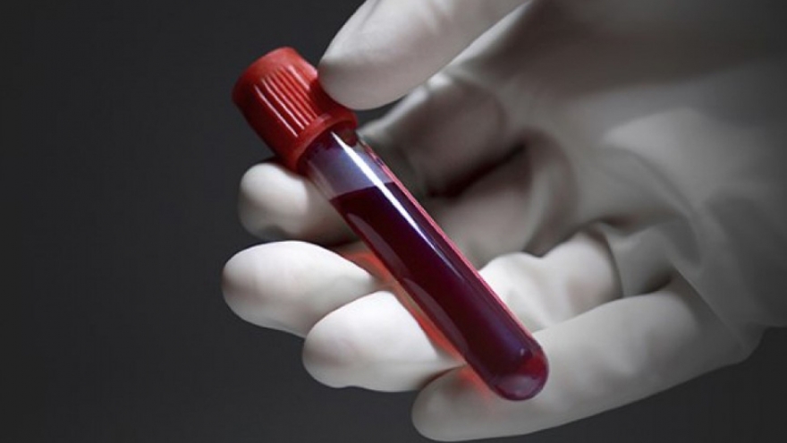 Con gái ngày càng giống người yêu cũ của vợ, tôi muốn xét nghiệm ADN